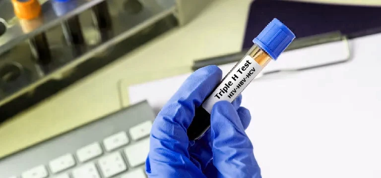 What is Triple H Test: Uses, Preparation, Procedure, Cost & Diagnostic Lab Near You